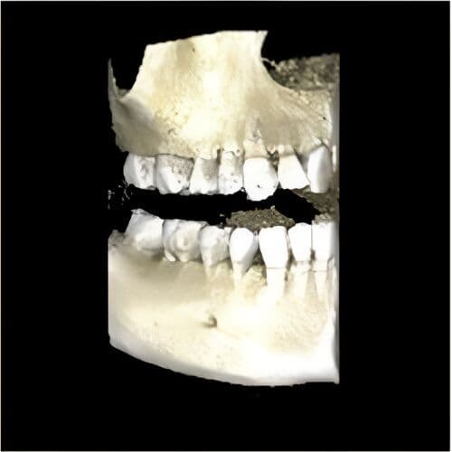 Planmeca Pan + CBCT (8x8 FOV) 3D Dental X-Ray System thumbnail 4