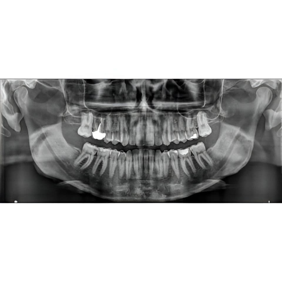 Carestream CS8100 Pano Panoramic Dental X-Ray System thumbnail 6
