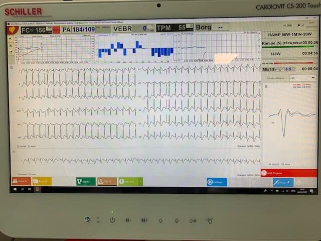 Schiller CS-200 EKG and Cardiac Stress Test System thumbnail 2