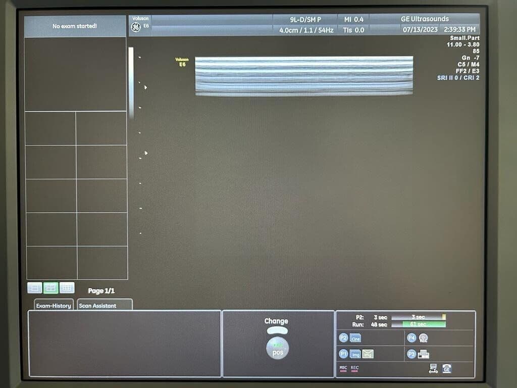 GE 9L-D Linear Ultrasound Transducer thumbnail 2