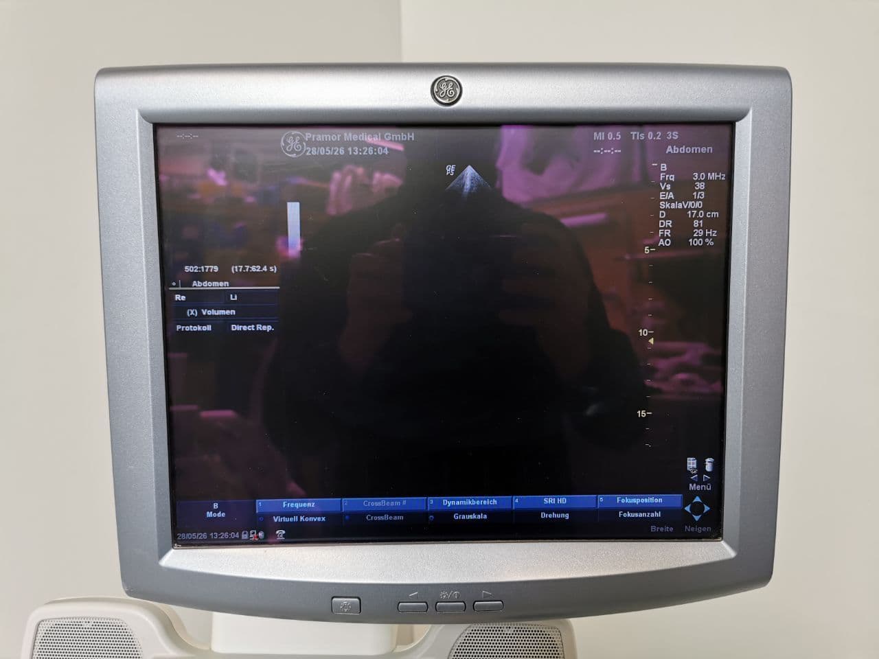 GE Healthcare 3s — Cardiac Ultrasound Probe thumbnail 6