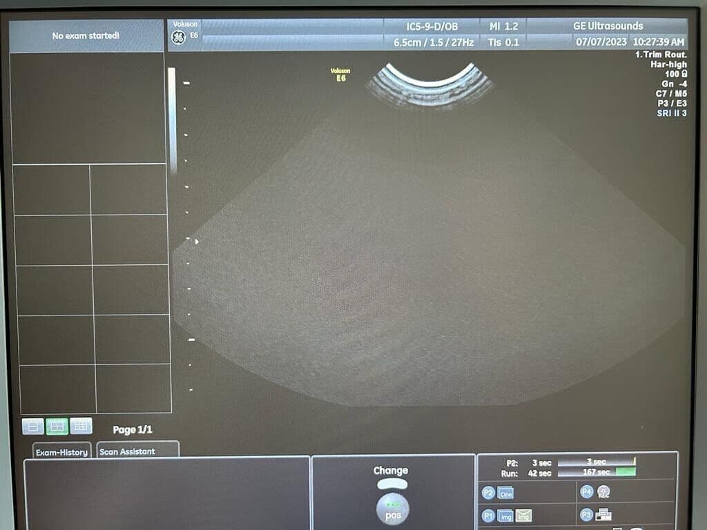 GE IC5-9-D Intracavitary Ultrasound Transducer image 1