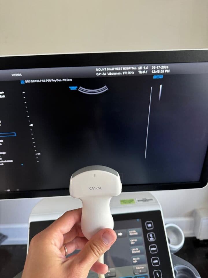 Samsung WS80 Elite Premium Ultrasound System thumbnail 4