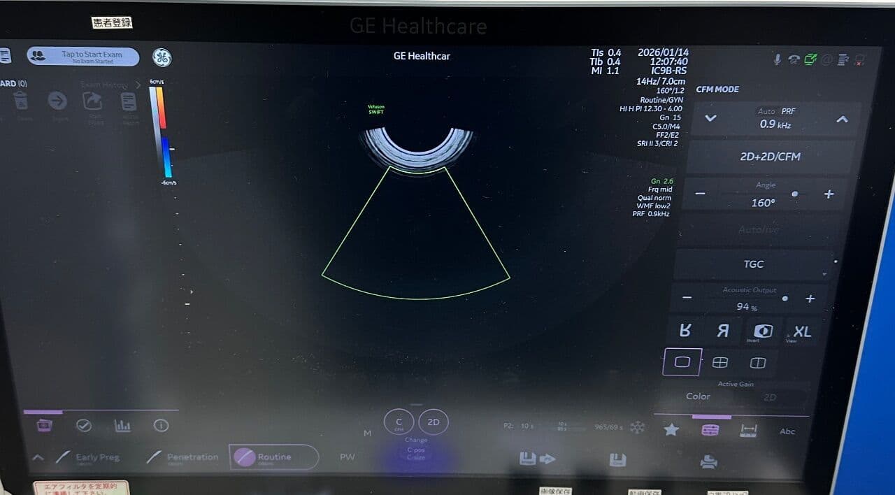 OB/GYN Ultrasound Imaging — GE Voluson Swift BT23 thumbnail 3