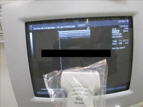 Siemens Acuson 6L3 Linear Ultrasound Transducer for Sequoia C512 thumbnail 2