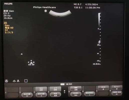 Philips C5-2 Convex Array Ultrasound Probe thumbnail 3