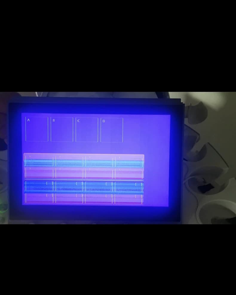 GE Voluson E6 / E8 / E10 Touch Screen Repair Service (Touch Failure / No Display / Ghost Touch / Screen Distortion) thumbnail 2