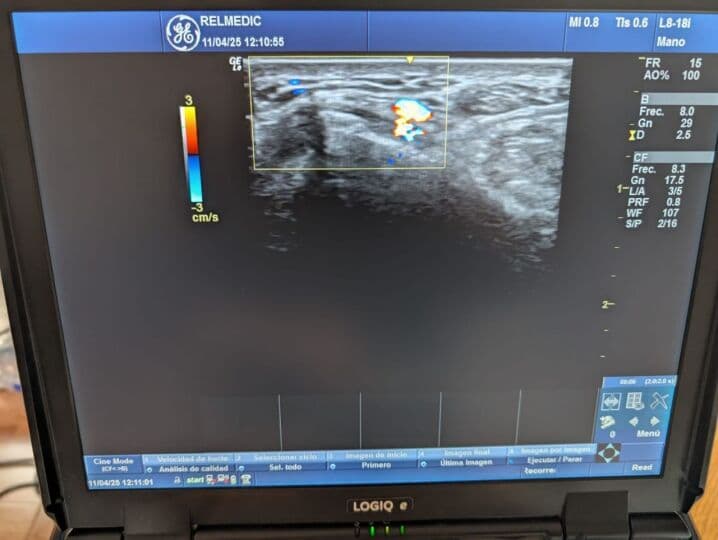 GE L8-18i-RS Intraoperative Stick Ultrasound Transducer thumbnail 9