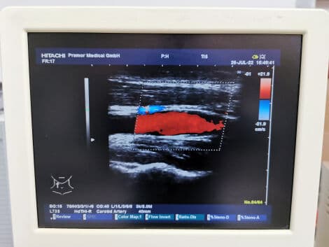 Hitachi EUP-L73S Linear Array Ultrasound Transducer thumbnail 2
