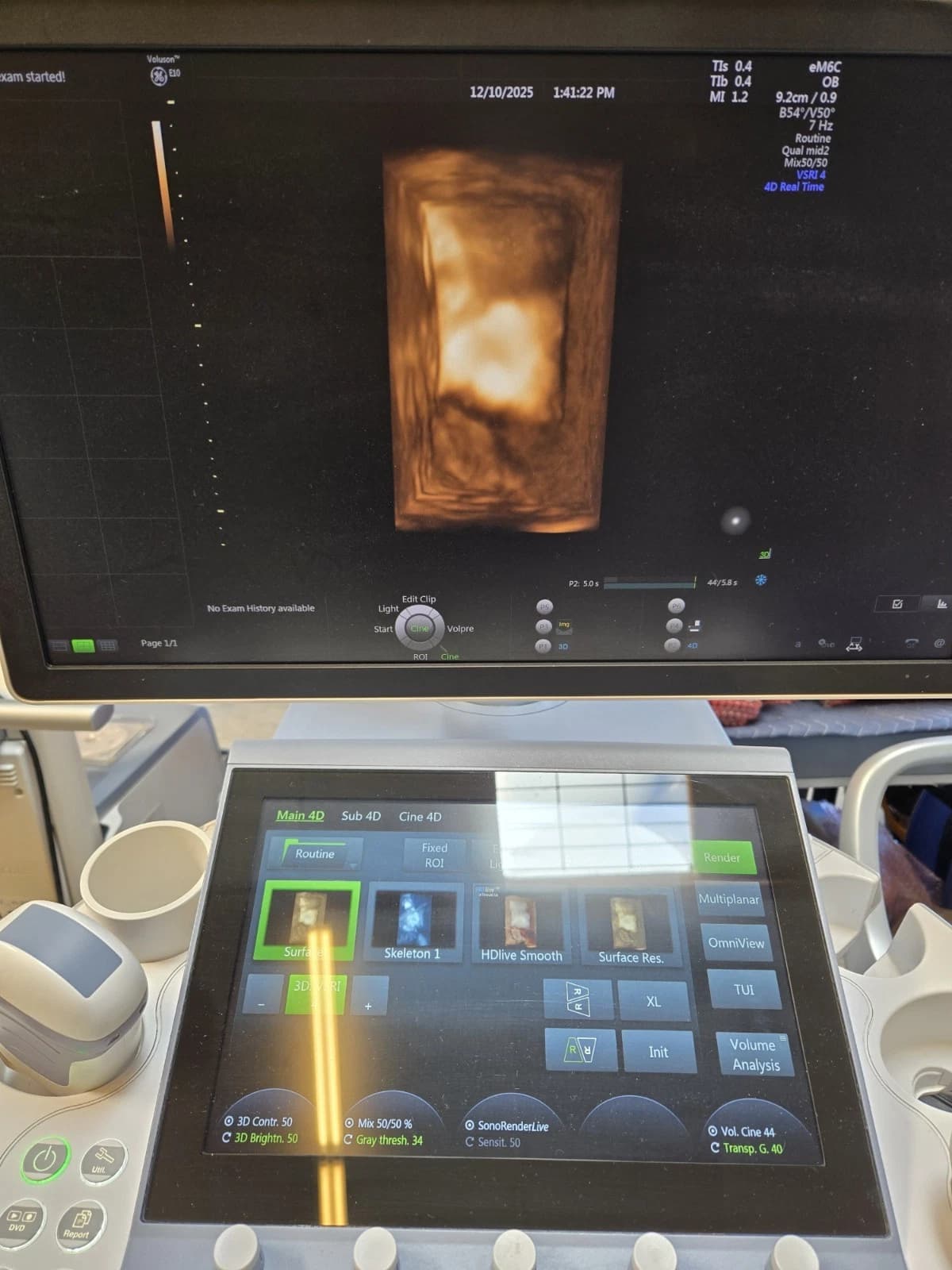 GE EM6C Electronic Micro-Convex Ultrasound Probe for LOGIQ and Versana Systems – Abdominal, OB/GYN, Pediatric and Emergency Imaging