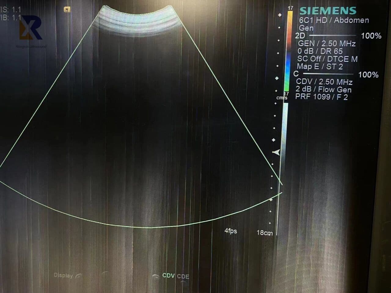 Siemens 6C1HD S2000 Curved Array Ultrasound Transducer thumbnail 5