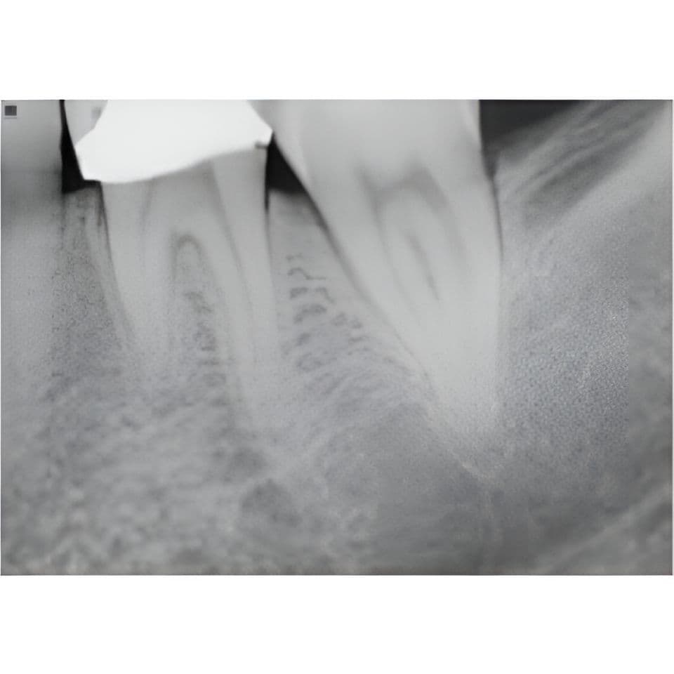 Carestream CS9000 Pan/CBCT 3D Dental X-Ray System thumbnail 11