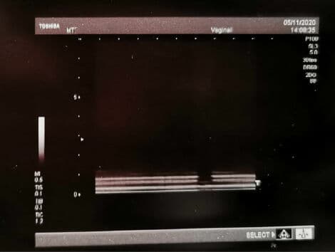 Linear Biopsy Ultrasound Probe: Toshiba PLF-308P Transducer thumbnail 2