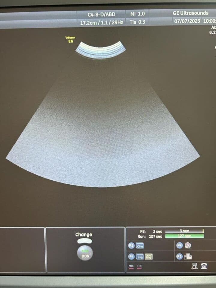 GE C4-8-D Micro Convex Ultrasound Transducer thumbnail 4