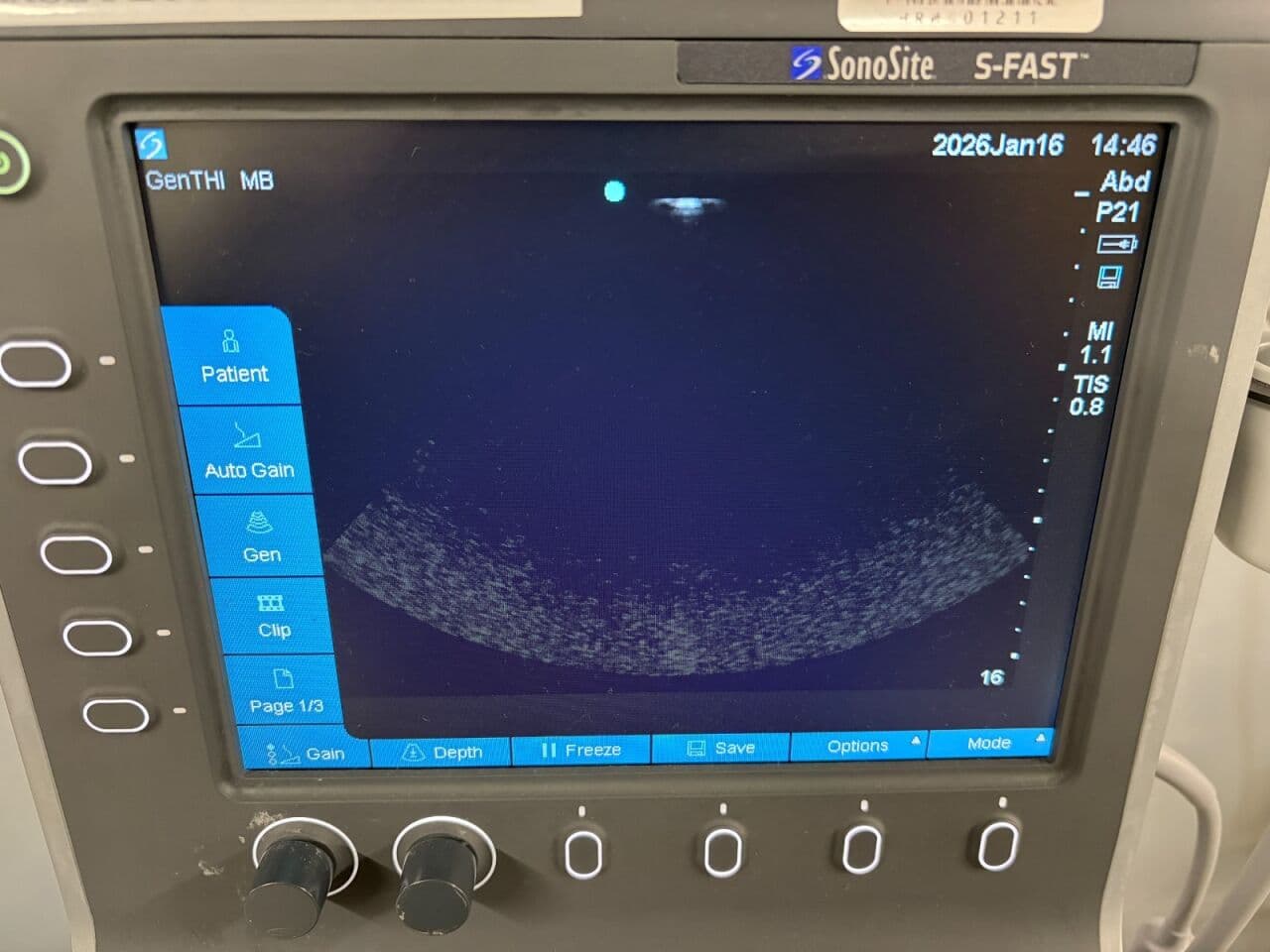 Sonosite P07578 S-FAST Ultrasound System thumbnail 5