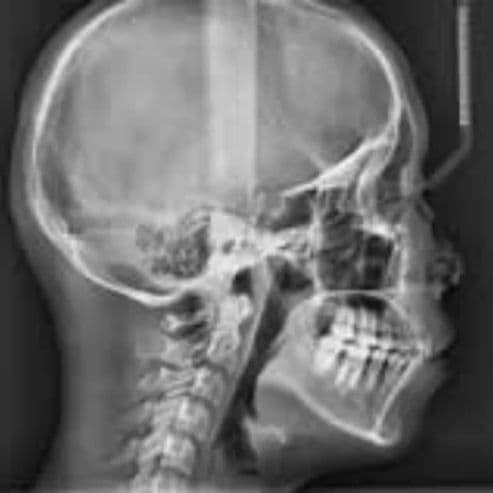 Vatech PaX-i Pan/Ceph Dental X-Ray System thumbnail 6