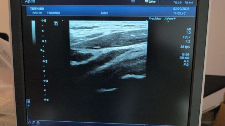 Toshiba PLT-1204BT Linear Ultrasound Transducer thumbnail 8