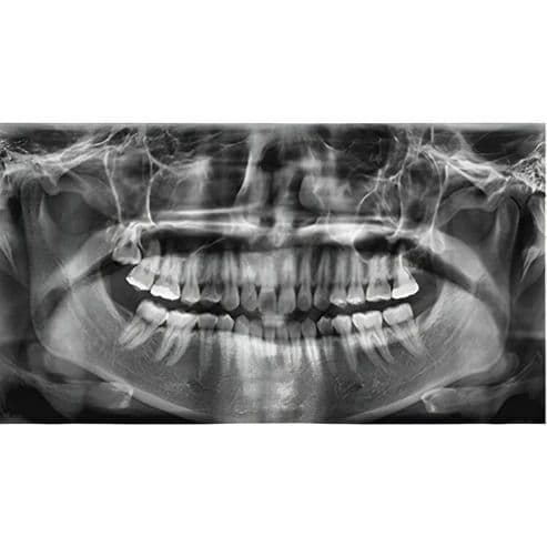 Vatech PaX-i Pan/Ceph Dental X-Ray System thumbnail 2