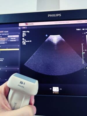 Philips X6-1 Matrix Array Ultrasound Transducer thumbnail 5