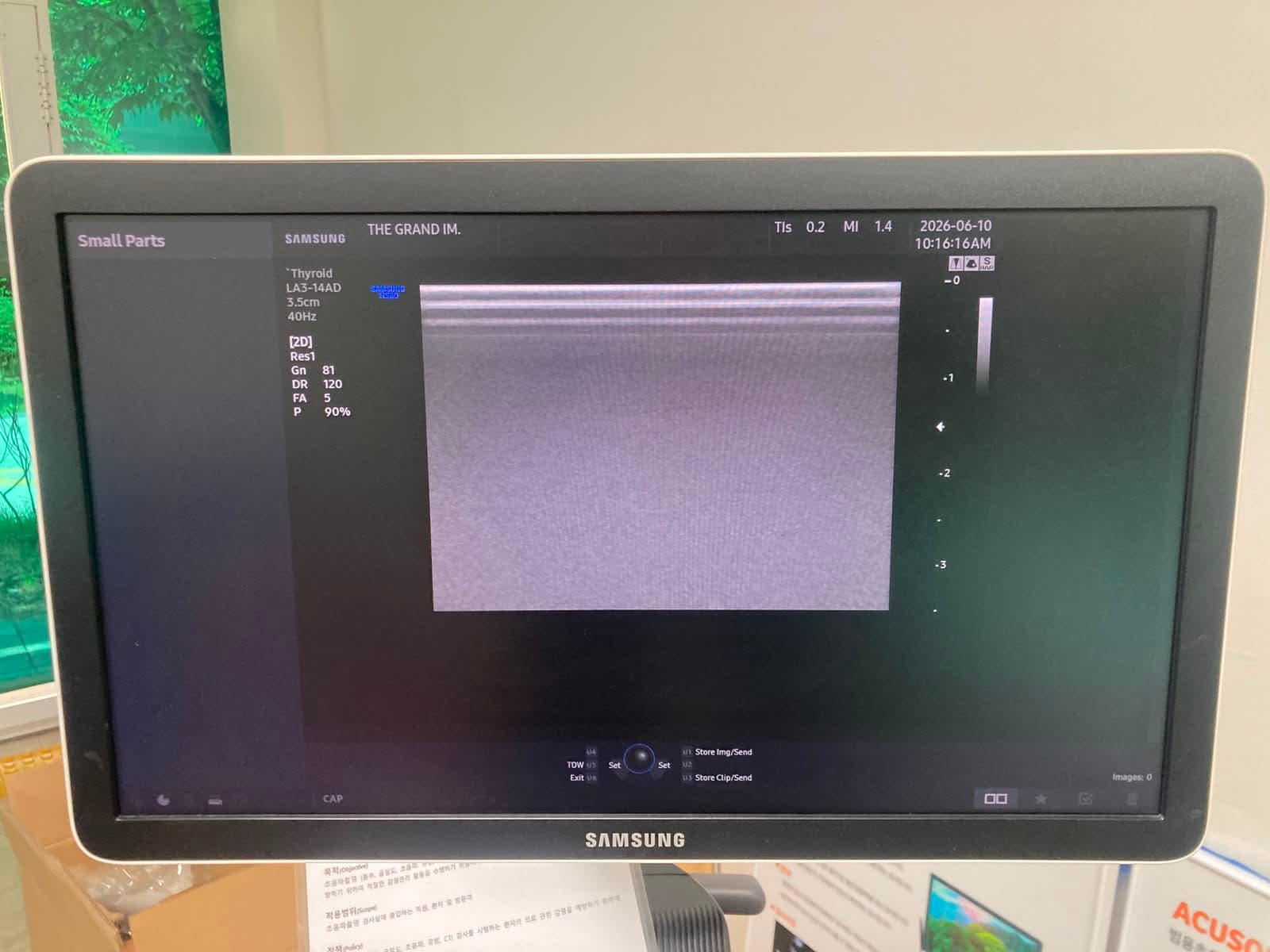 Samsung Medison HS60 Premium Ultrasound System with LA3-14AD PA1-5A CA1-7AD Probes Excellent Condition thumbnail 8
