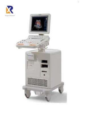Philips HD6 Mobile Ultrasound System image 1