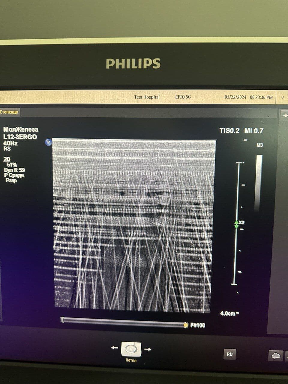 Philips Epiq 5G Ultrasound System image 1