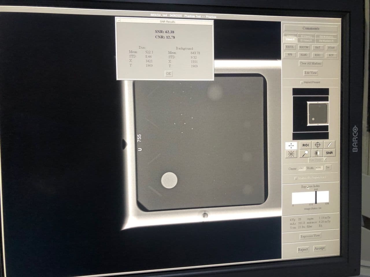 Hologic Selenia Digital Mammography System thumbnail 7
