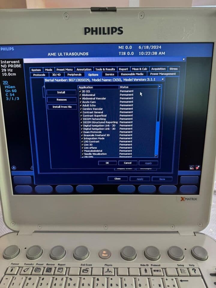 Philips CX50 Portable Cardiac Ultrasound System thumbnail 6