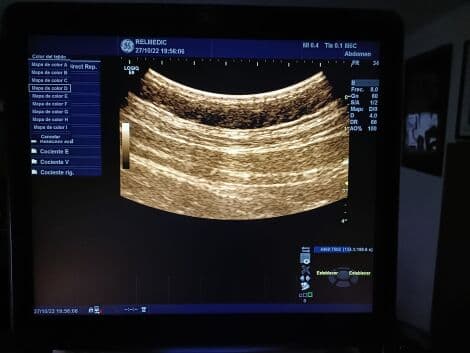 GE M6C-D Matrix Convex Ultrasound Transducer thumbnail 9