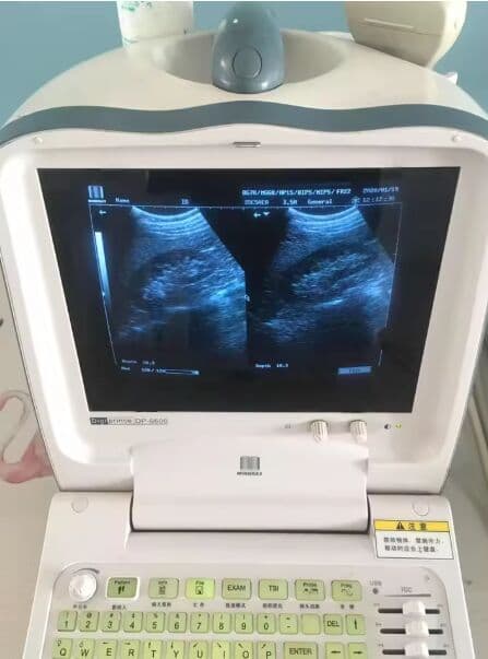 Mindray DP6600 Portable Ultrasound Scanner with Convex Probe thumbnail 3