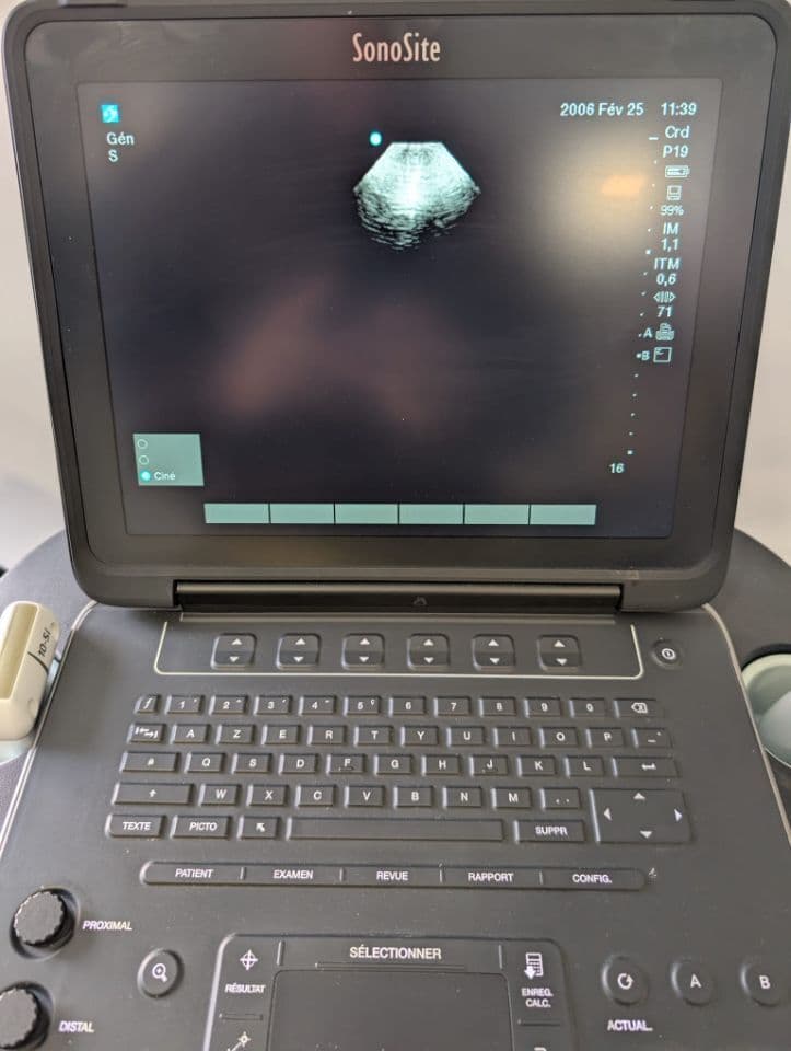 Sonosite rP19x Cardiac Ultrasound Transducer Probe thumbnail 7