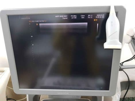 Samsung L5-13IS Linear Array Ultrasound Probe for HERA, RS and HS Series Systems – Vascular, Small Parts, MSK and Breast Imaging