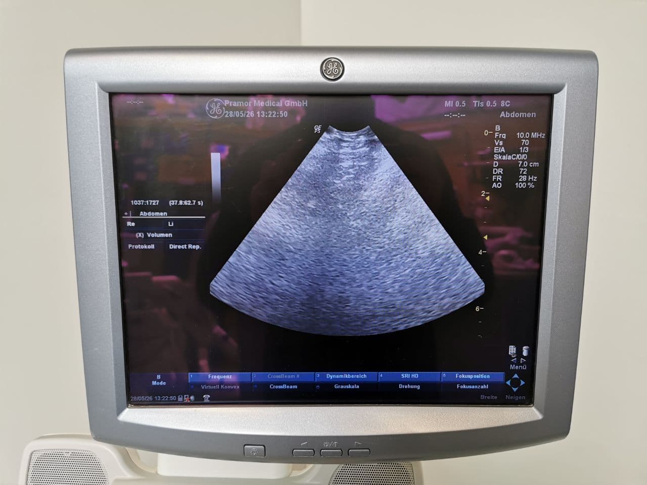 Micro-Convex GE Healthcare 8C Ultrasound Transducer thumbnail 6