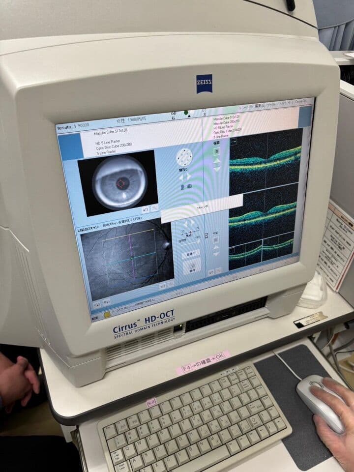 Zeiss Cirrus 4000: High-Definition OCT for Advanced Retinal Analysis thumbnail 2