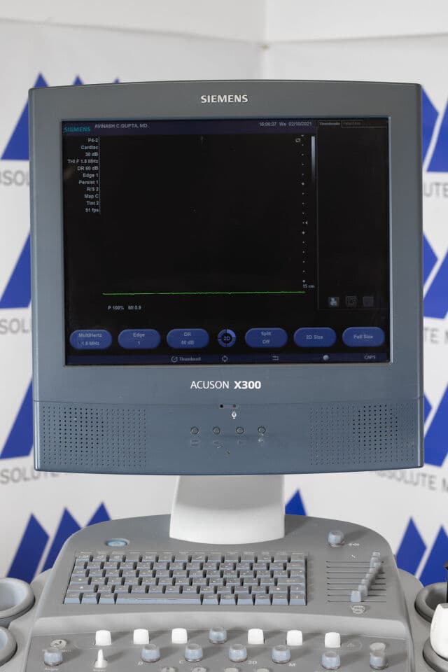Siemens ACUSON X300 Portable Diagnostic Ultrasound System thumbnail 2