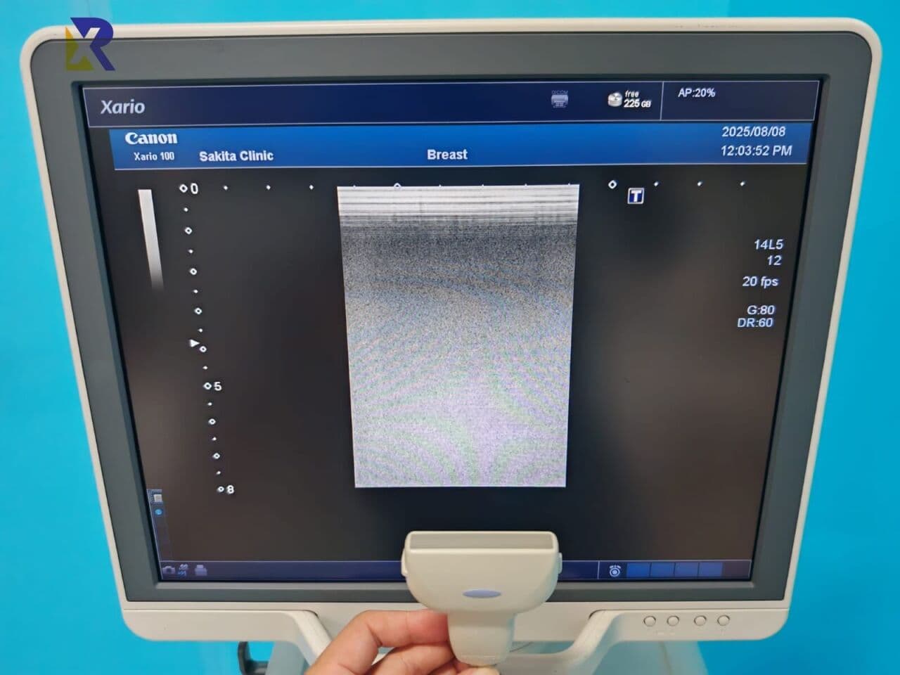 Canon Xario 100 / TUS-X100 Diagnostic Ultrasound System thumbnail 6