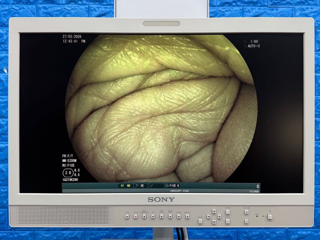 For Sale FUJINON Scope Model: EG-530FP Gastroscope Gastroscope thumbnail 4