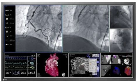 Eizo RadiForce LS560W 56-inch QFHD Surgical Display Monitor thumbnail 2