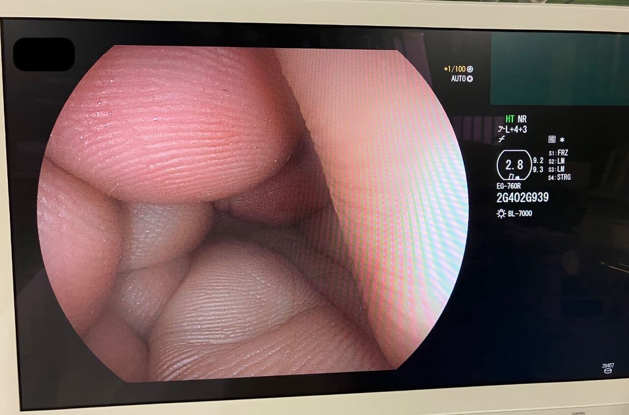 Complete Fujinon Eluxeo 7000 Video Endoscopy System thumbnail 3