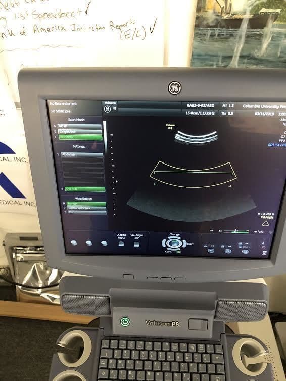 GE RAB2-6-RS 3D/4D Curved Array Ultrasound Transducer thumbnail 2