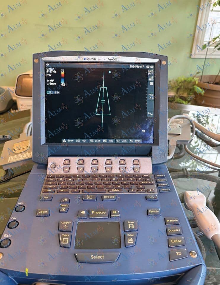Portable Ultrasound System — Sonosite MicroMaxx with Cardiac & Vascular Probes thumbnail 3
