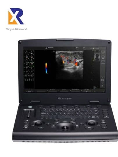 GE Versana Active Plus Portable Ultrasound System image 1