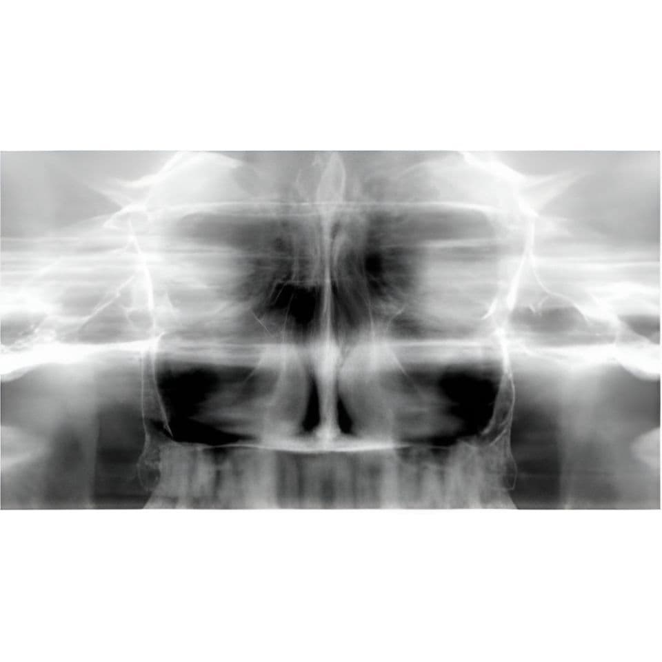 Carestream CS9000 Pan/CBCT 3D Dental X-Ray System thumbnail 9