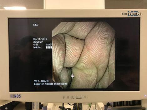 OLYMPUS GF-UCT140-AL5 Ultrasound Gastroscope for EUS Procedures thumbnail 2
