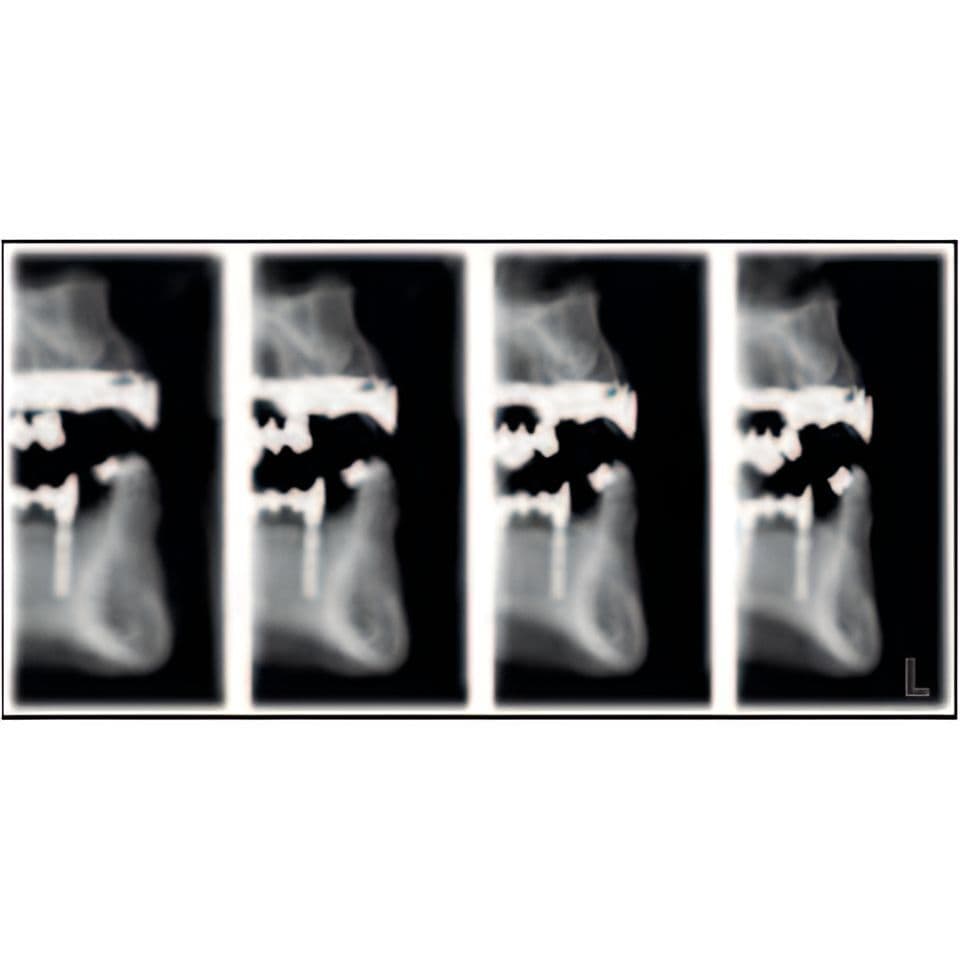 Planmeca ProMax Pan Dental X-Ray System thumbnail 15