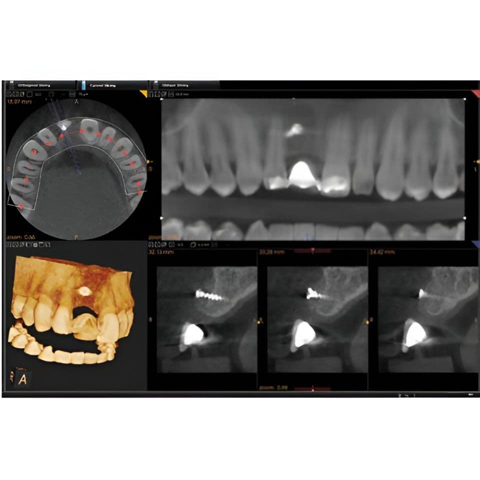 Carestream CS9000 Pan/CBCT 3D Dental X-Ray System thumbnail 4