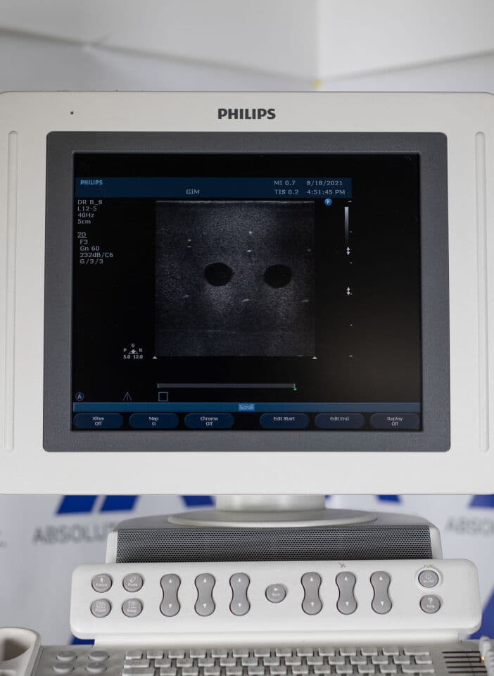 Philips HD11xe Ultrasound System thumbnail 10