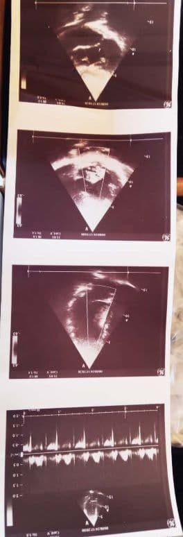 GE 3S-RS Sector Ultrasound Transducer thumbnail 5