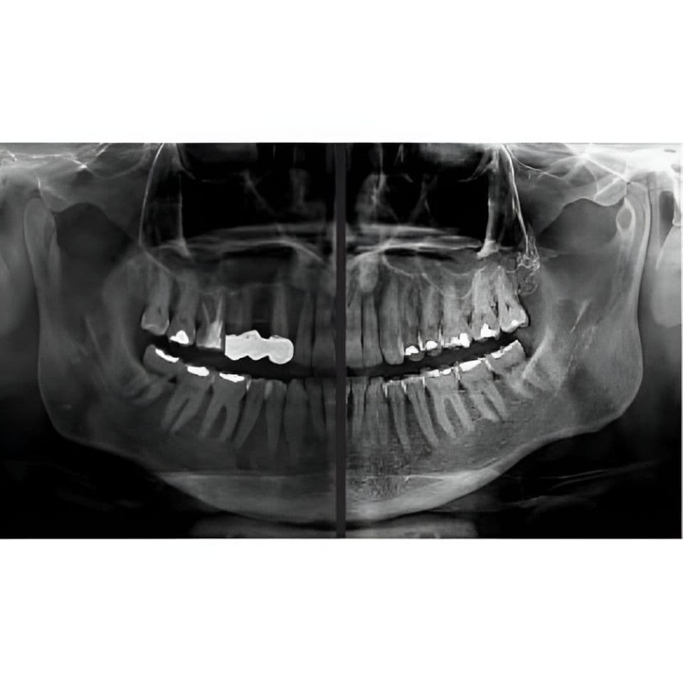 MyRay Hyperion X9 PRO Pan/Ceph/CBCT Dental X-Ray with 13x16 FOV thumbnail 12