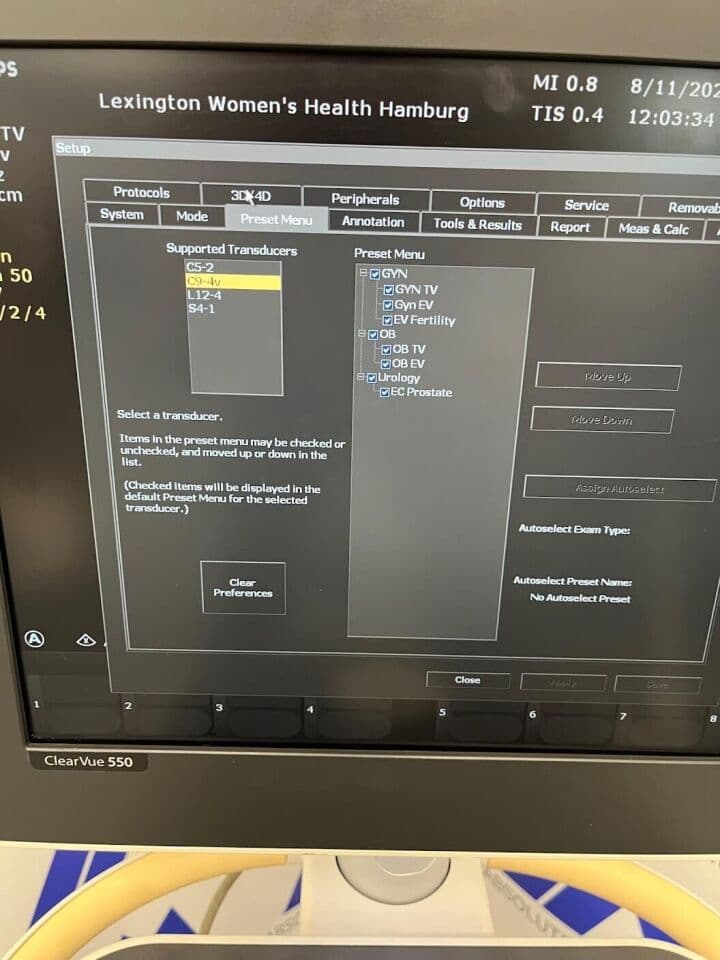 Philips ClearVue 550 Ultrasound System for General Imaging thumbnail 3